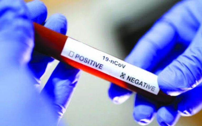 test coronavirus