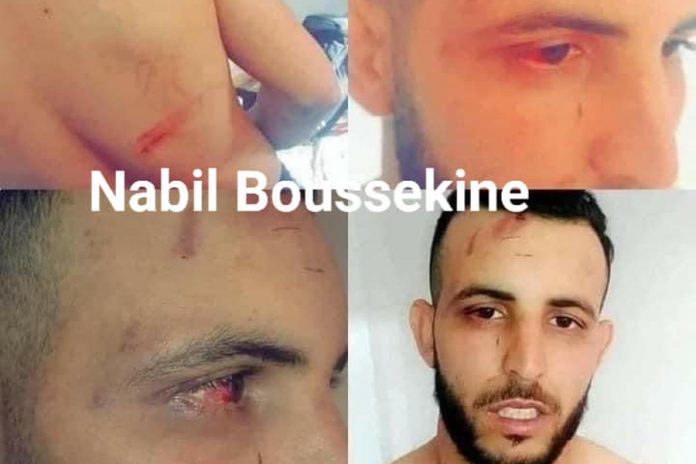 Les marques de la torture subie par Nabil Boussekine