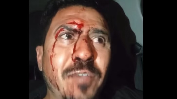 À Batna un professeur violement agressé par deux gendarmes à l’intérieur d’une brigade